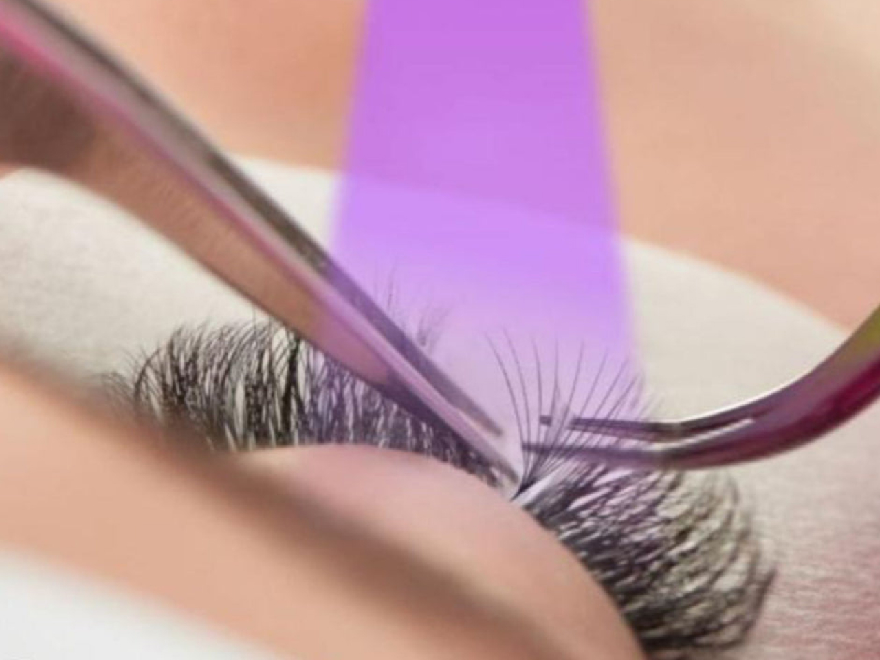 Procedimento estético 1